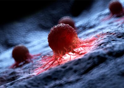 Human-Cancer-Cell-Illustration-400×284-1.jpeg