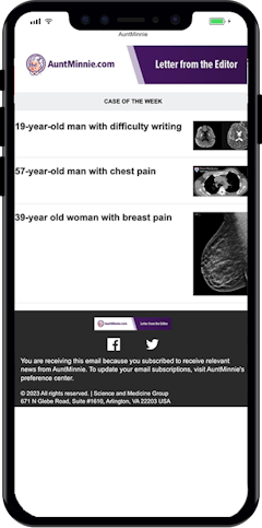 AI in radiology receives more positive coverage in U.S. news media