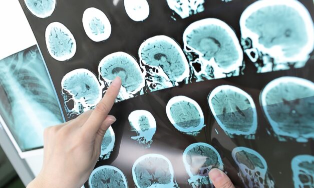 What new guidelines say to do to prevent a stroke