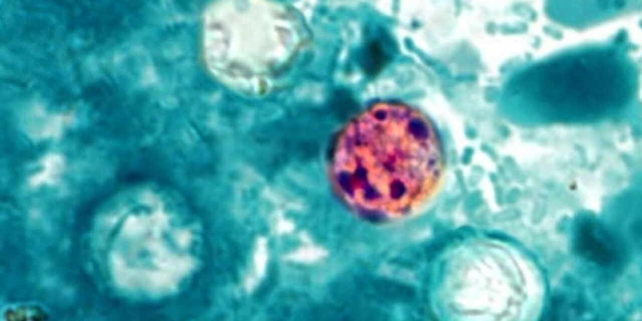 Taco Bell lettuce in 5 states, supplied by Taylor Farms, source of cyclospora outbreak