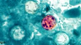 Taco Bell lettuce in 5 states, supplied by Taylor Farms, source of cyclospora outbreak J364SMDRRFBERALTRCULHRU6JI.jpg